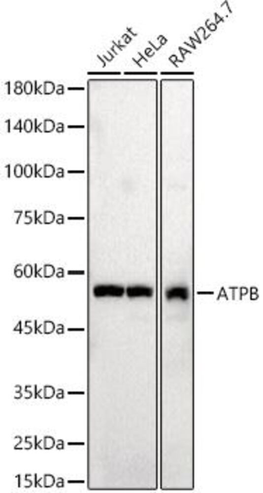 Anti-ATPB Antibody, 100 µl - Luminix Health