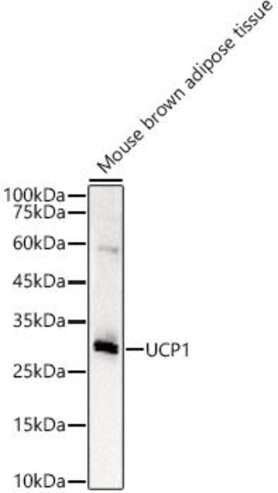 Anti-UCP1 Antibody, 100 µl - Luminix Health