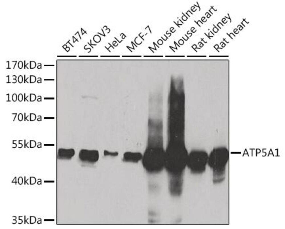 Anti-ATP5A Antibody, 100 µl - Luminix Health
