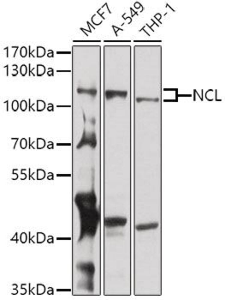 Anti-Nucleolin Antibody, 100 µl - Luminix Health