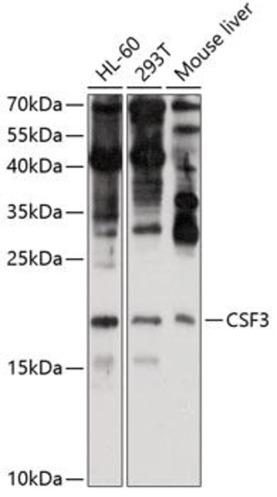Anti-G-CSF Antibody, 100 µl - Luminix Health
