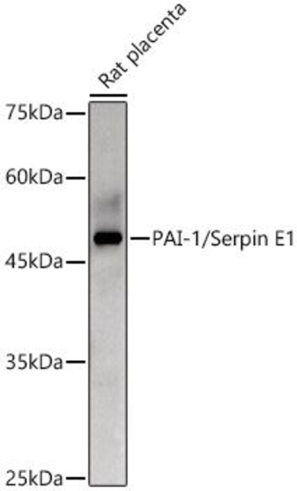 Anti-PAI1 Antibody, 100 µl - Luminix Health