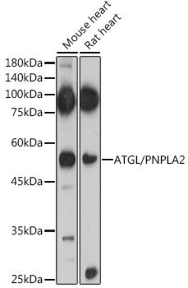 Image of A-Adipose Triglyceride Lipase Antib
