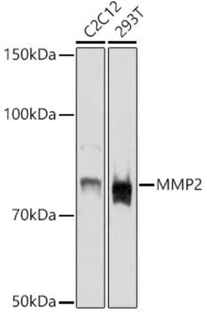 Anti-MMP2 Antibody, Density (D) 1 g/cm³, Storage temp. +4 °C - Luminix Health