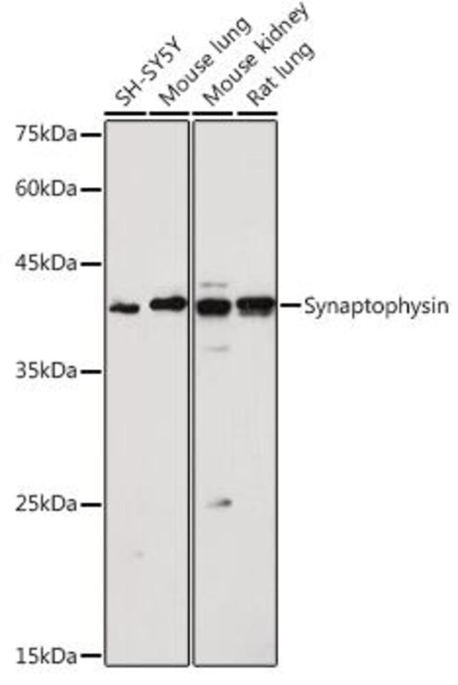 Anti-Synaptophysin Antibody, 100 µl - Luminix Health