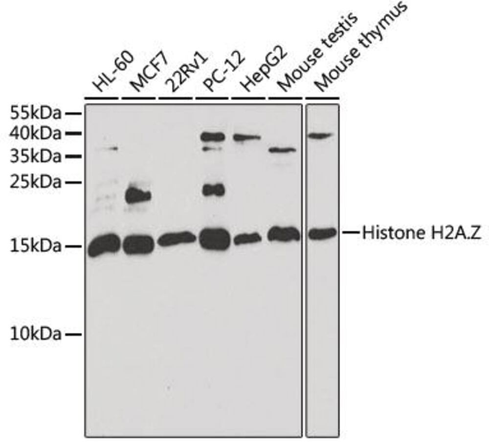 Anti-Histone H2A.Z Antibody, 100 µl - Luminix Health