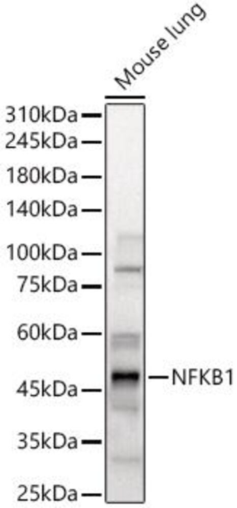 Anti-NFkB p105 / p50 Antibody, 100 µl - Luminix Health