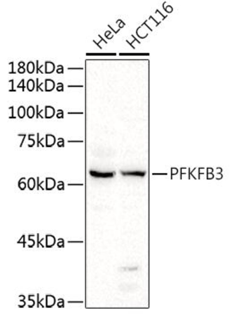 Anti-PFKFB3 Antibody, 100 µl - Luminix Health