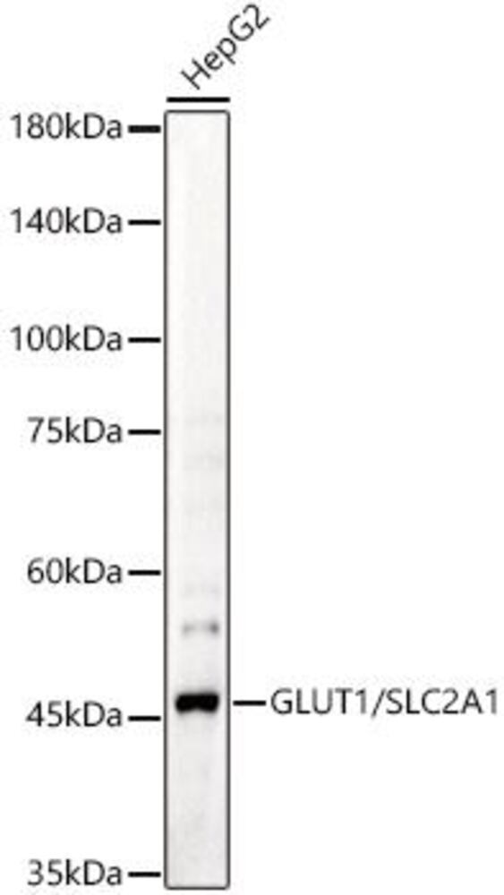 Anti-Glucose Transporter GLUT1 Antibody, 100 µl - Luminix Health