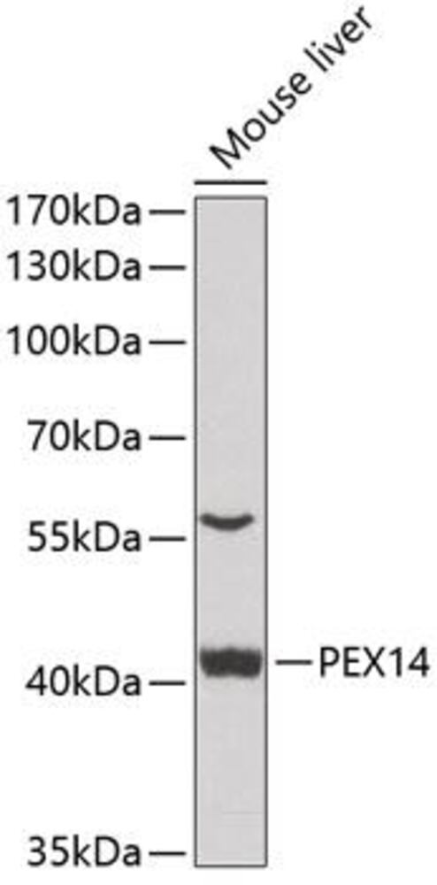 Anti-PEX14 Antibody, 100 µl - Luminix Health