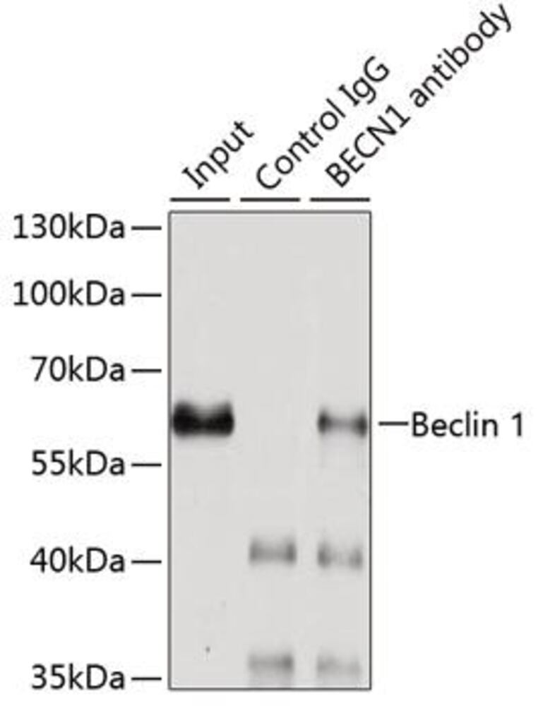 Anti-Beclin 1 Antibody, 100 µl - Luminix Health