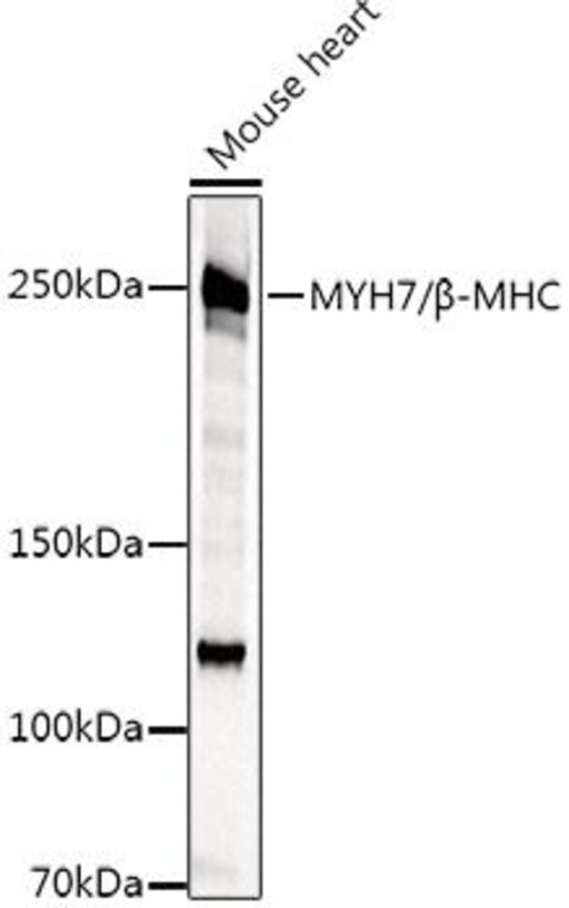 Image of A-Slow Skeletal Myosin Heavy chain Antib