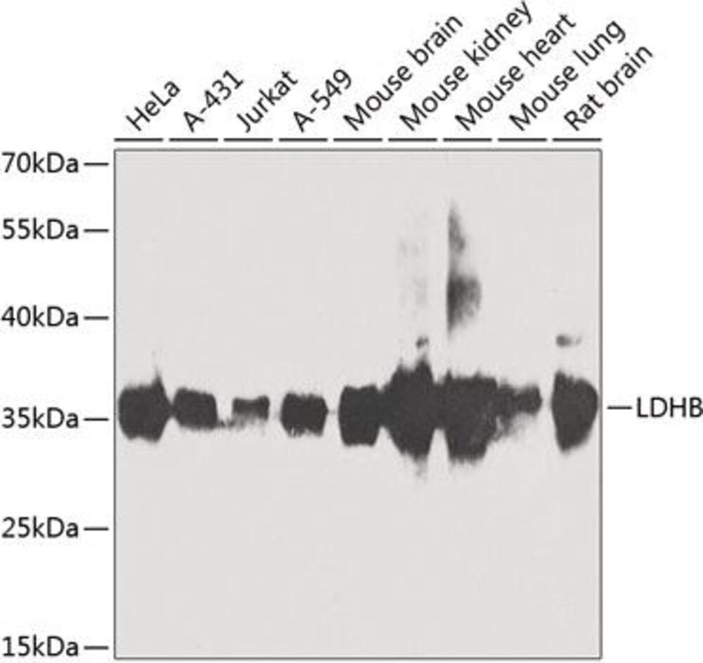 Image of A-Lactate Dehydrogenase B / LDH-B Antib