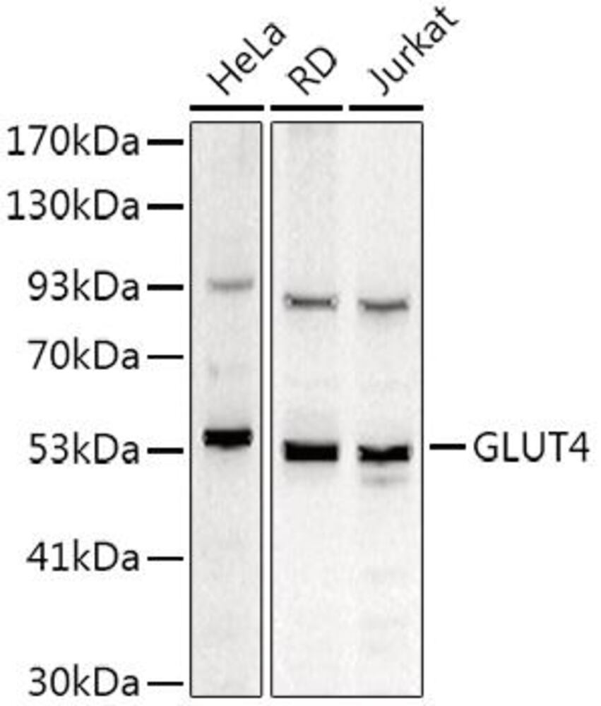 Anti-Glucose Transporter GLUT4 Antibody, 100 µl - Luminix Health
