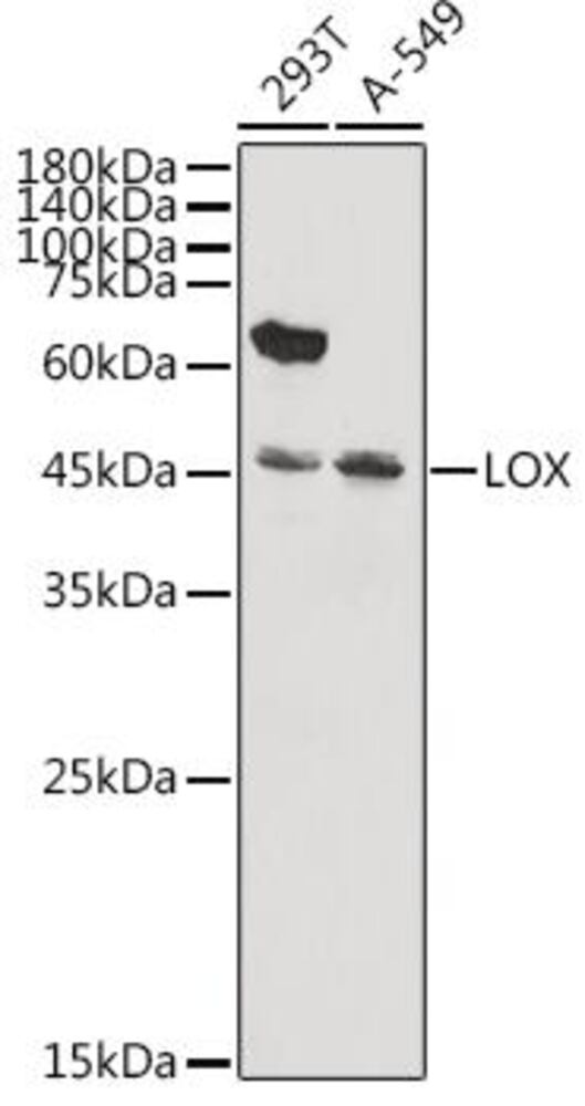 Anti-LOX Antibody, 100 µl - Luminix Health