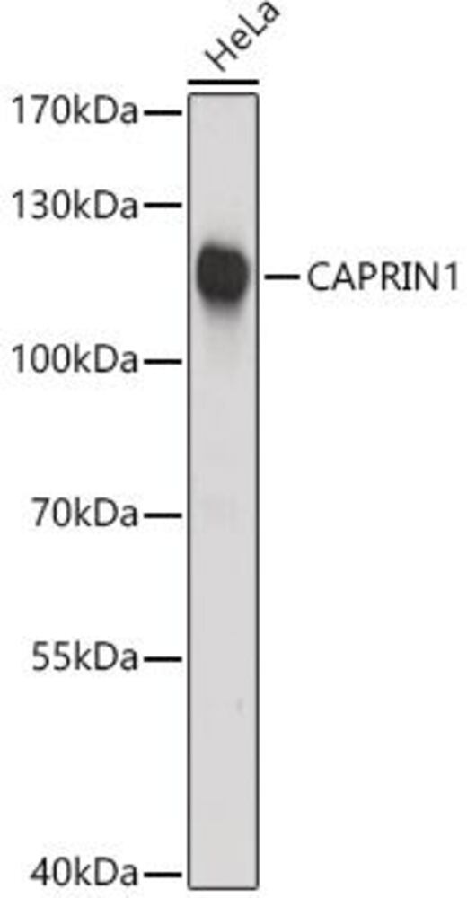 Anti-Caprin-1 Antibody, 100 µl - Luminix Health