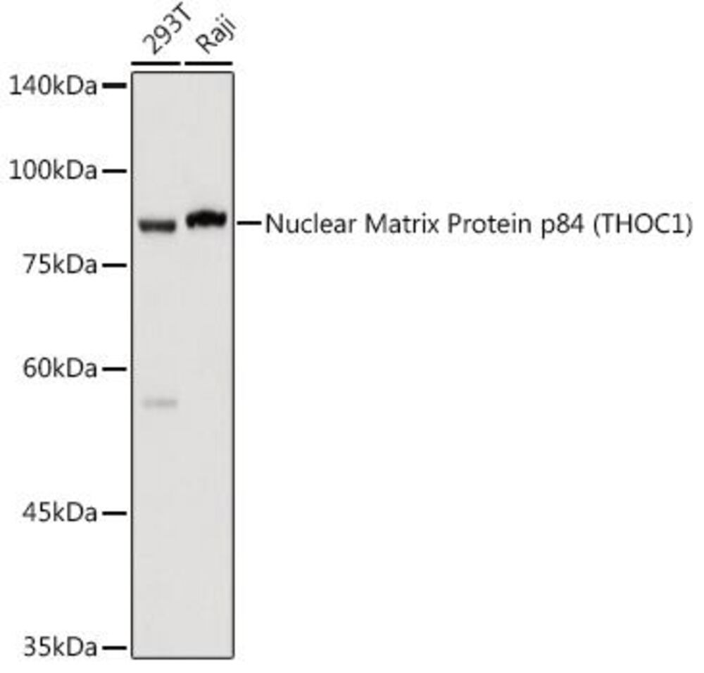 Anti-Nuclear Matrix Protein p84 Antibody, 100 µl - Luminix Health