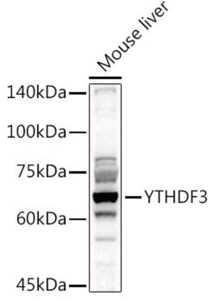 Anti-YTHDF3 Antibody, 100 µl - Luminix Health
