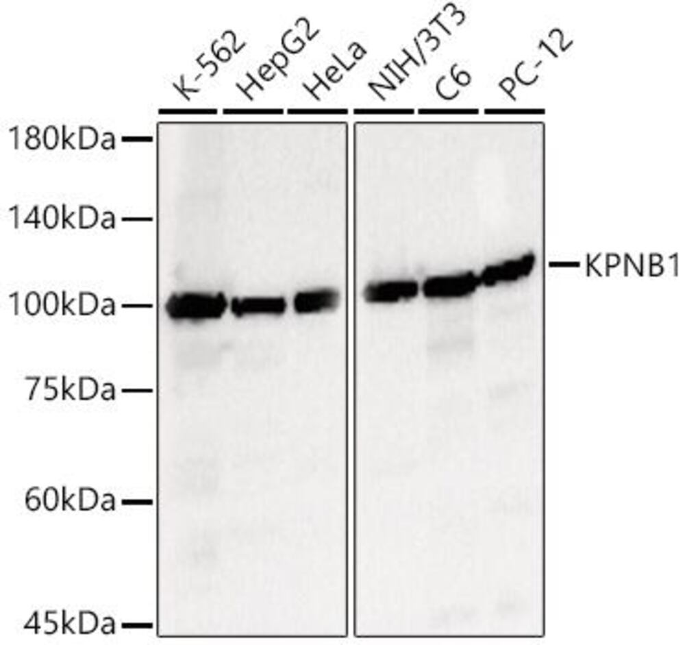 Anti-KPNB1 Antibody, 100 µl - Luminix Health