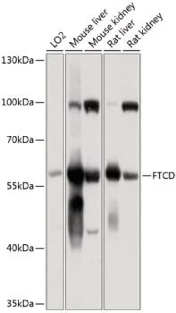 Anti-58K Golgi protein Antibody, 100 µl - Luminix Health