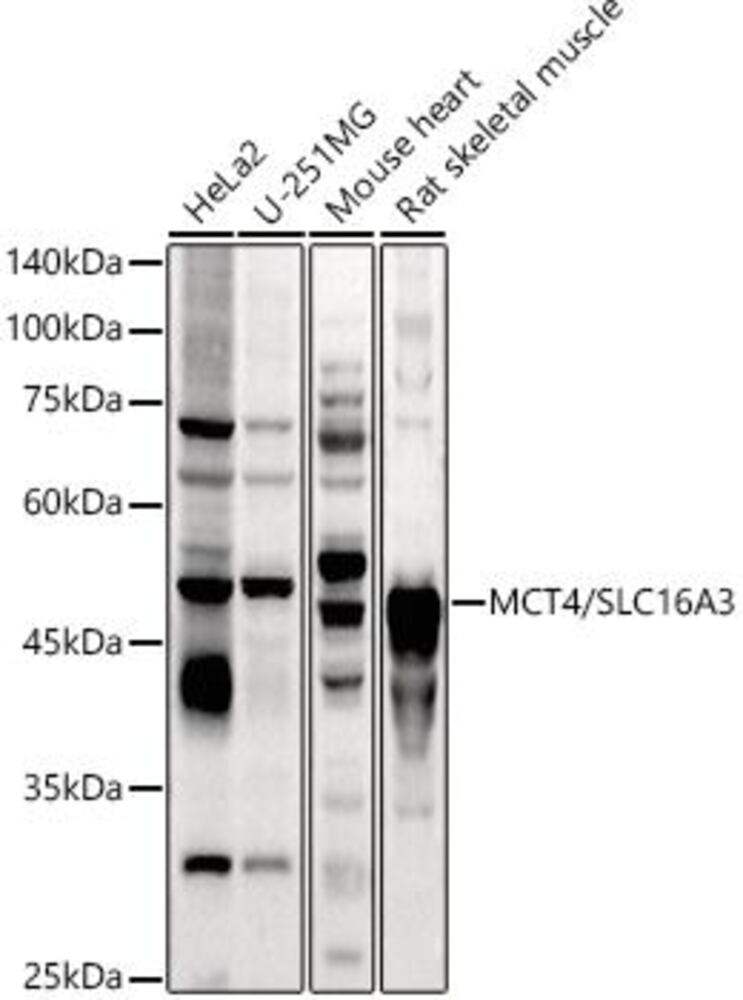 Anti-SLC16A3 / MCT 4 Antibody, 100 µl - Luminix Health