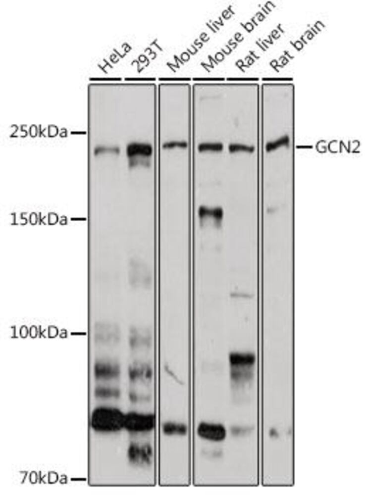 Anti-GCN2 Antibody, 100 µl - Luminix Health
