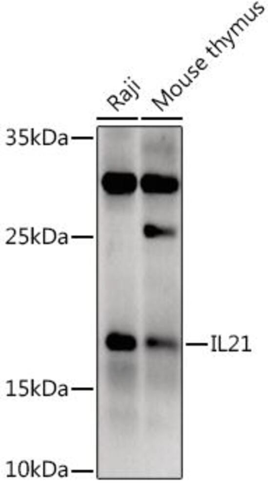 Anti-IL-21 Antibody, 100 µl - Luminix Health