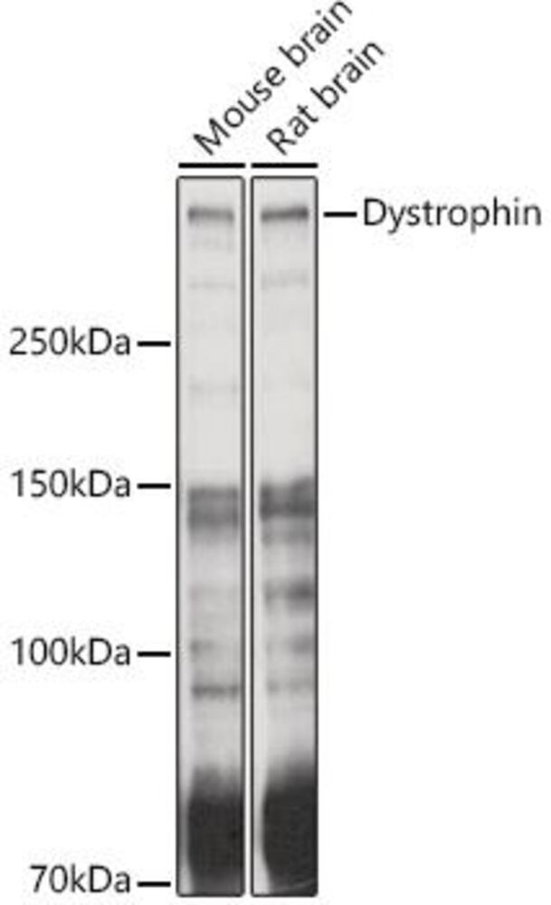 Anti-Dystrophin Antibody, 100 µl - Luminix Health