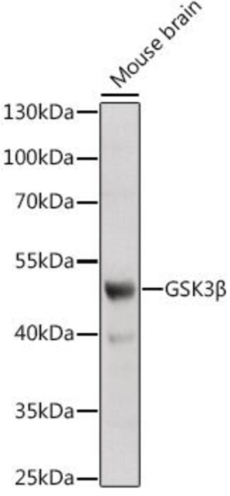 Anti-GSK3 beta Antibody, 100 µl - Luminix Health