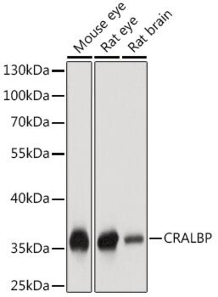 Anti-CRALBP Antibody, 100 µl - Luminix Health