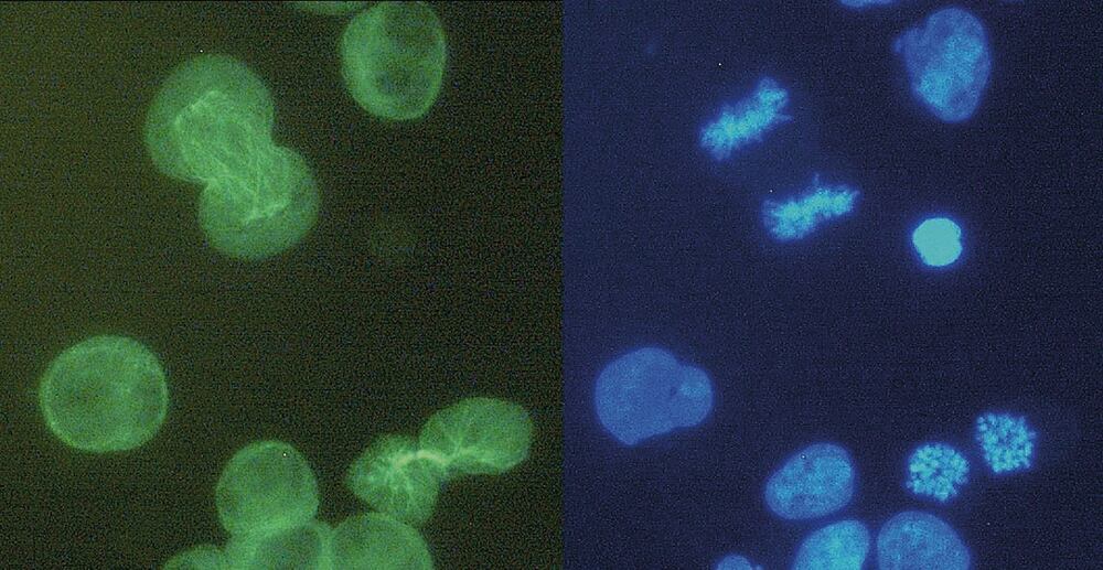 Anti-alpha Tubulin Antibody [YOL1/34], 100 µg - Luminix Health