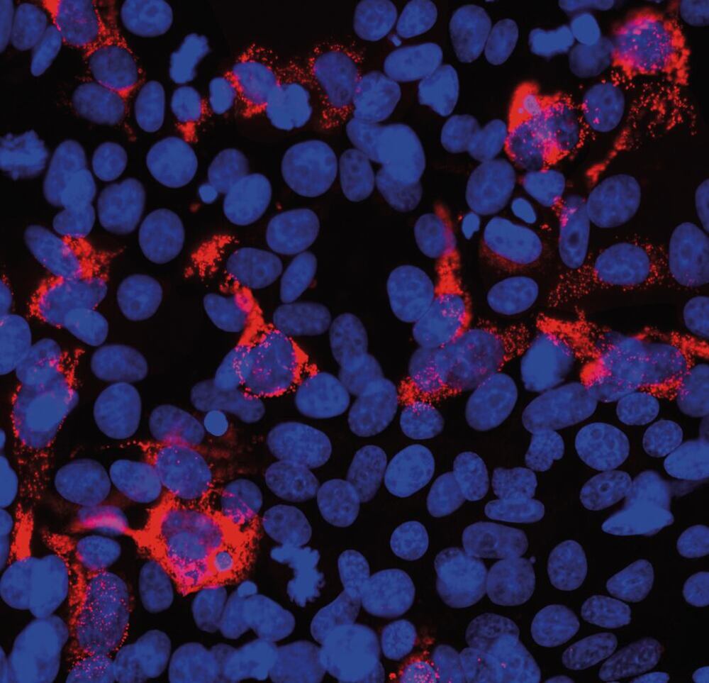 Image of A-SARSCoV2 Spike GlycoprotRBDAntib [5G8]
