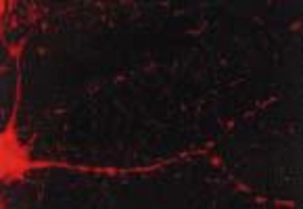Anti-CaMKII alpha Antibody [6G9], 100 µg - Luminix Health