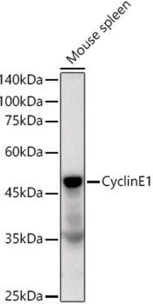 Anti-Cyclin E1 Antibody [ARC51383], 100 µl - Luminix Health