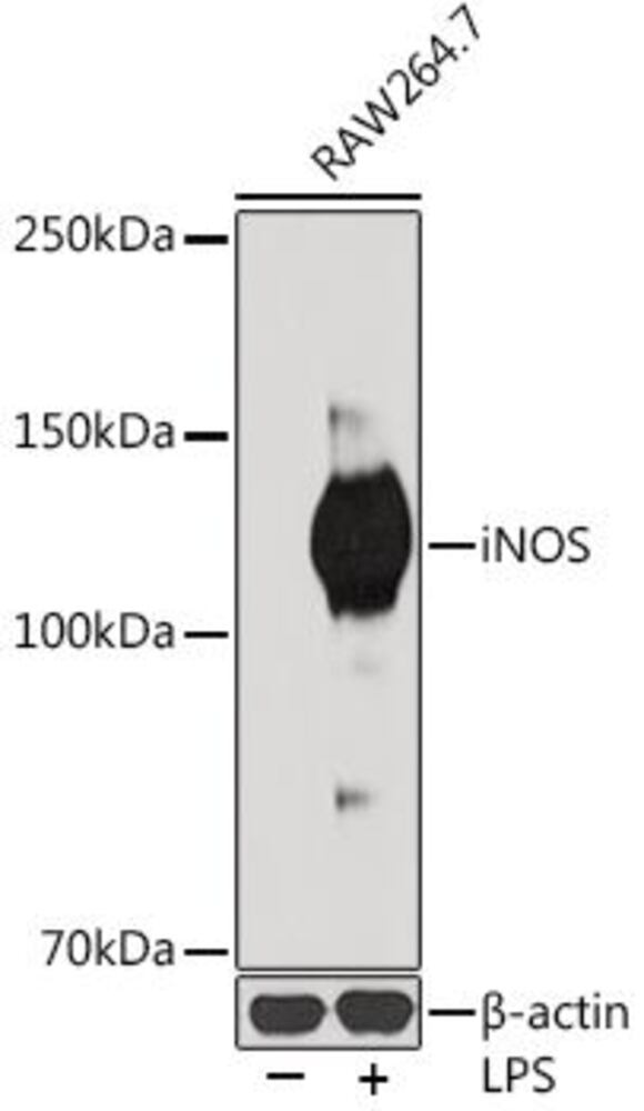 Anti-iNOS Antibody [ARC0832], 100 µl - Luminix Health