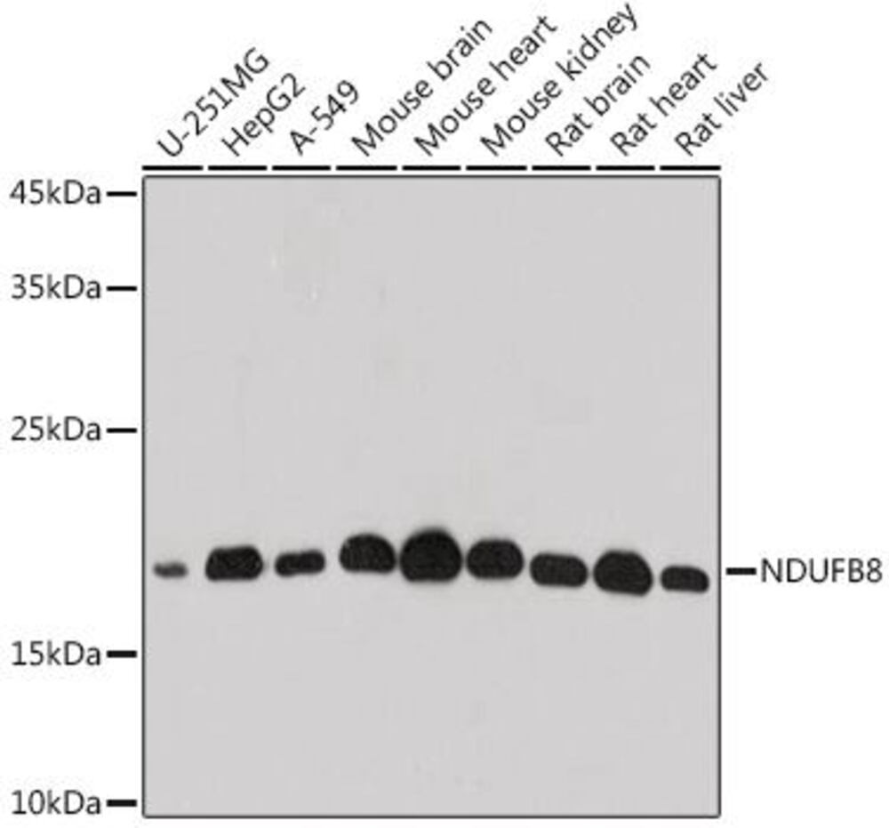 Anti-NDUFB8 Antibody, 100 µl - Luminix Health