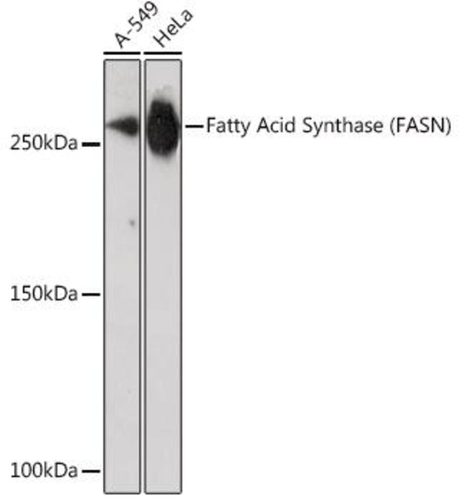 Image of A-Fatty Acid Synthase Antib [ARC0377]