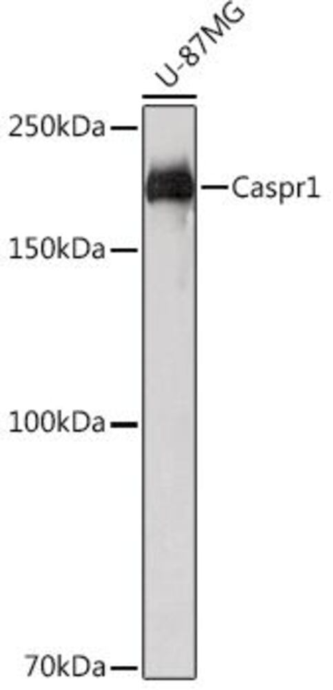 Anti-Caspr Antibody [ARC2084], 100 µl - Luminix Health