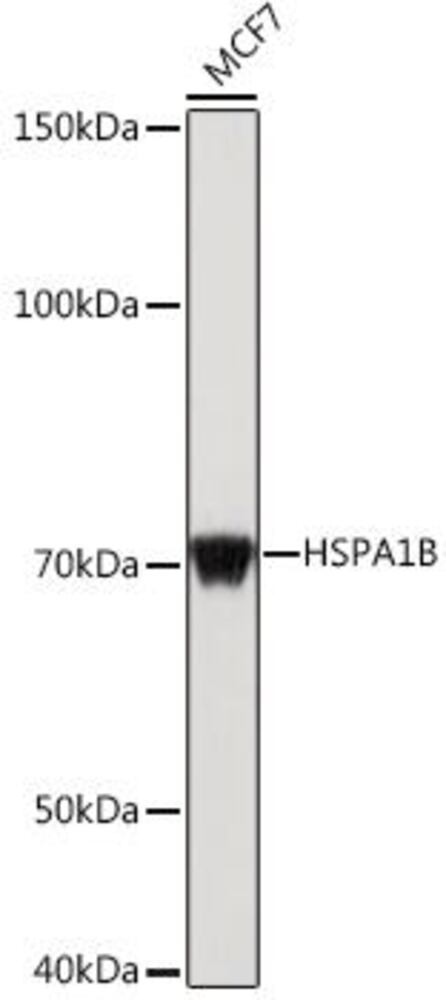 Anti-HSP70 Antibody, 100 µl - Luminix Health