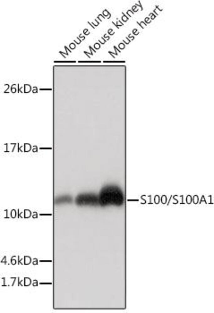 Anti-S100 alpha Antibody [ARC0404], 100 µl - Luminix Health