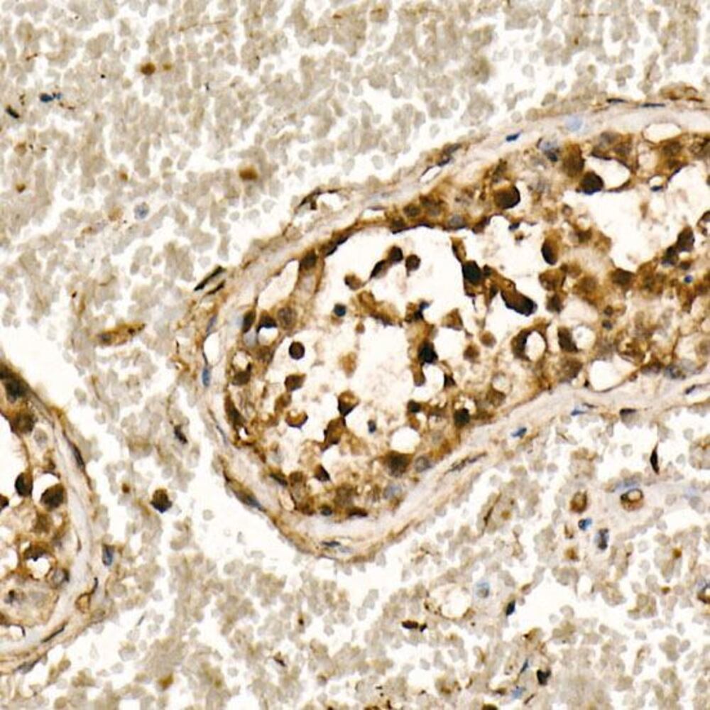 Anti-Smad3 Antibody [ARC53861], 100 µl - Luminix Health