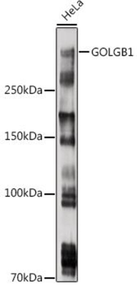 Anti-Giantin Antibody, 100 µl - Luminix Health