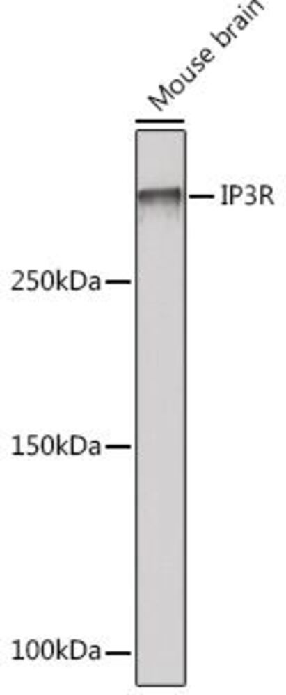 Anti-IP3 receptor Antibody [ARC1007], 100 µl - Luminix Health