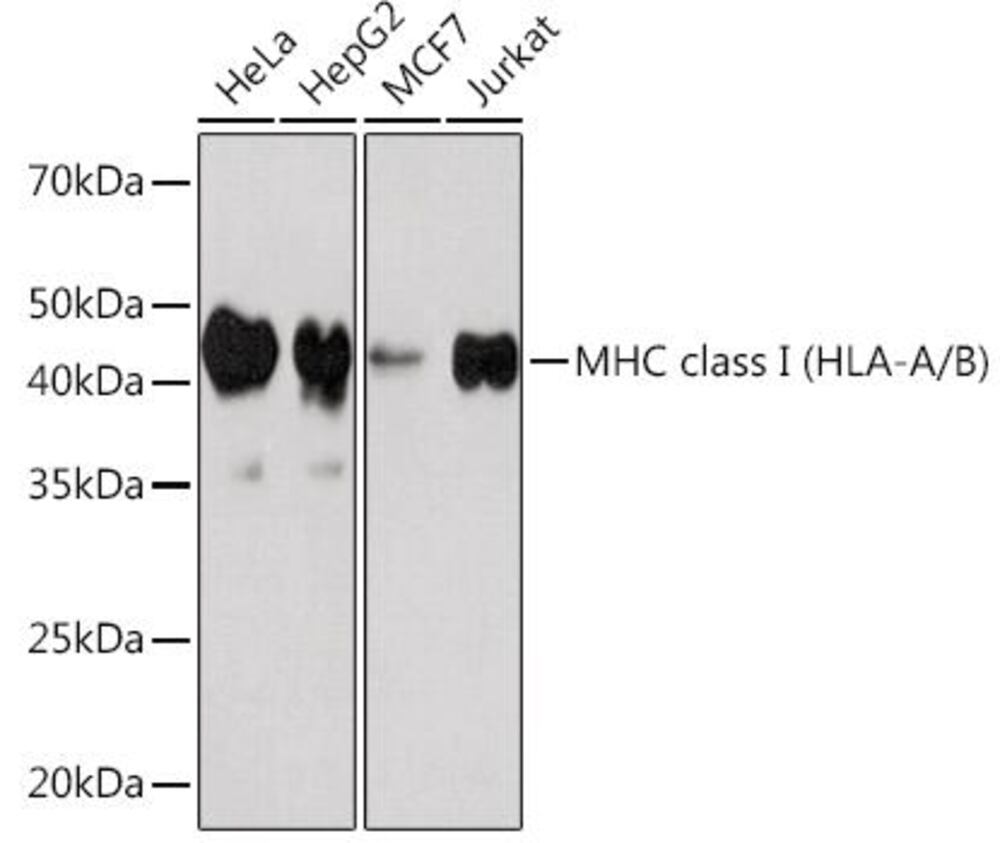 Anti-HLA-A + HLA-B Antibody [ARC1291], 100 µl - Luminix Health