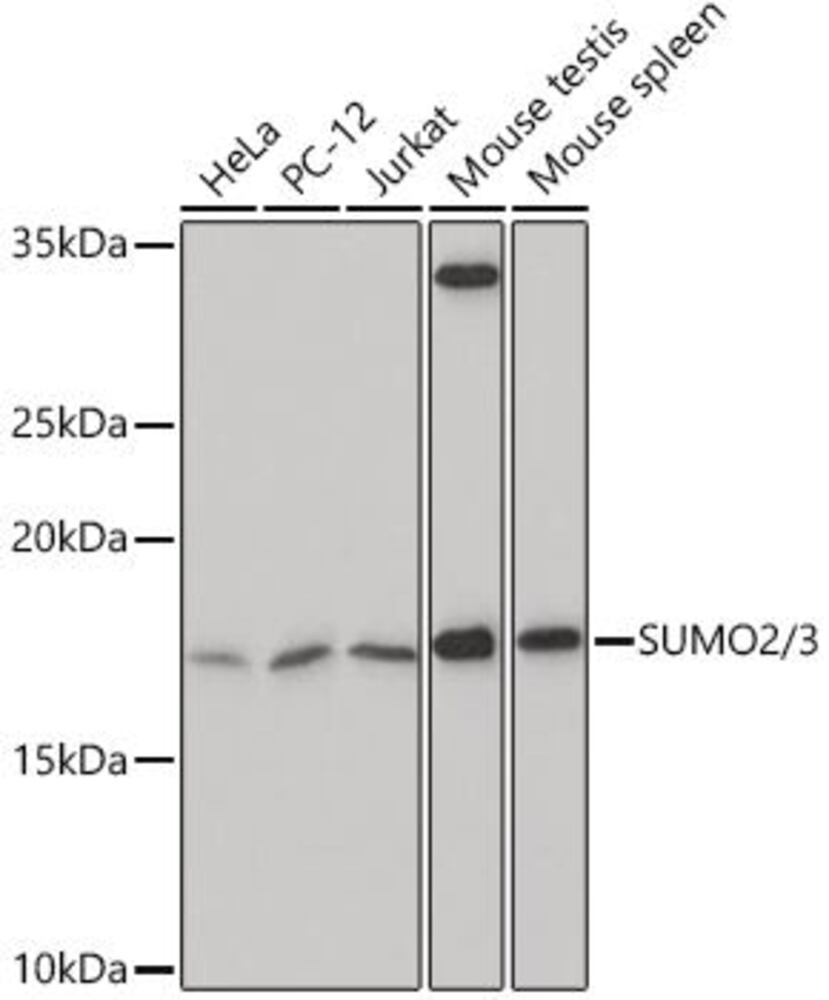 Anti-Sumo 2 + Sumo 3 Antibody [ARC1186], 100 µl - Luminix Health