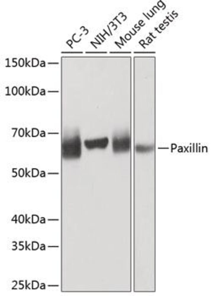 Anti-Paxillin Antibody [ARC0368], 100 µl - Luminix Health