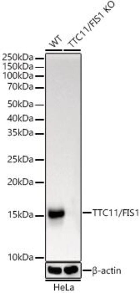 Anti-TTC11 / FIS1 Antibody [ARC5010-01], 100 µl - Luminix Health