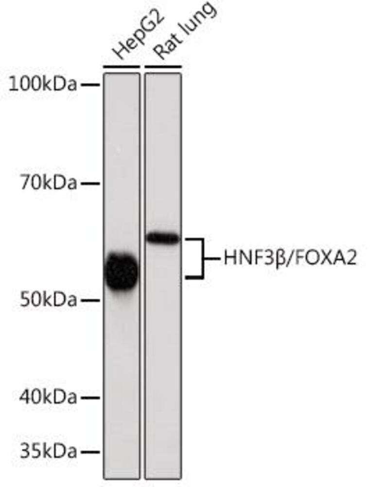 Anti-FOXA2 Antibody [ARC0391], 100 µl - Luminix Health
