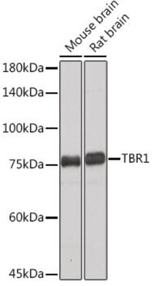 Anti-TBR1 Antibody [ARC2198], 100 µl - Luminix Health