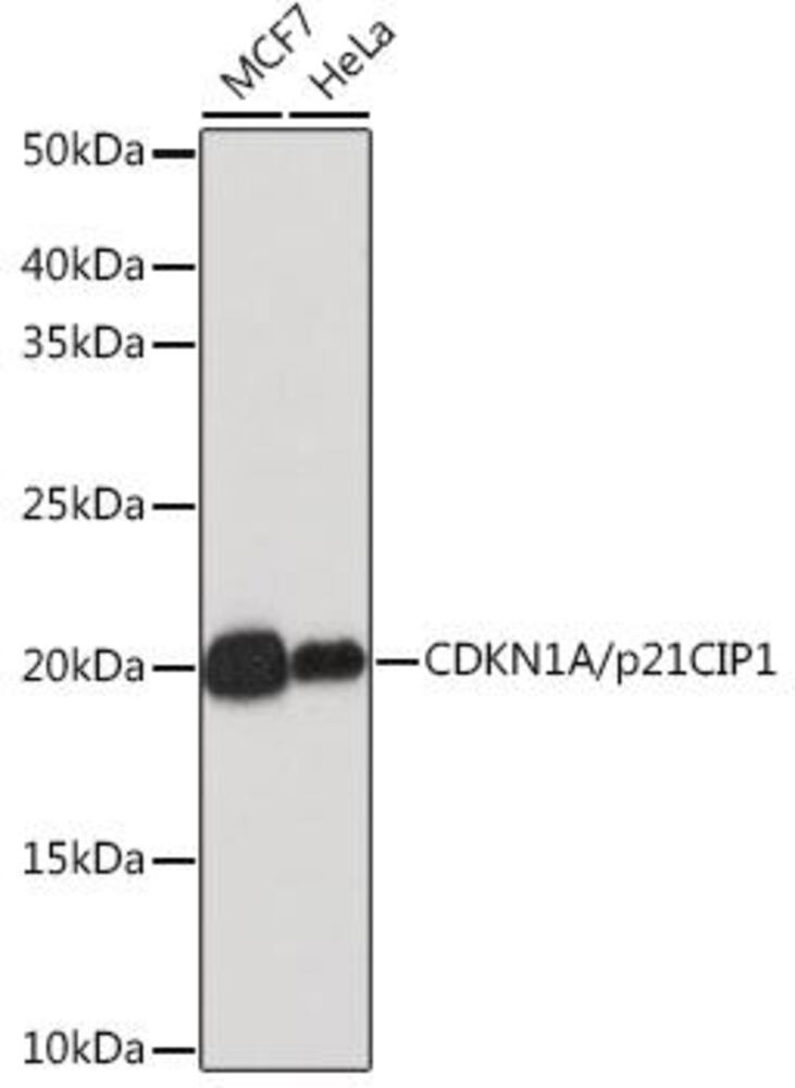 Anti-p21 Antibody [ARC51040], 100 µl - Luminix Health